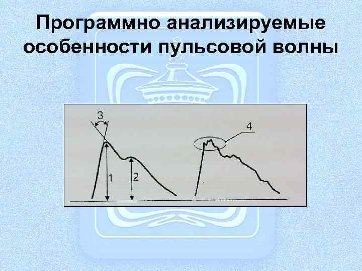 Программно анализируемые особенности пульсовой волны 
