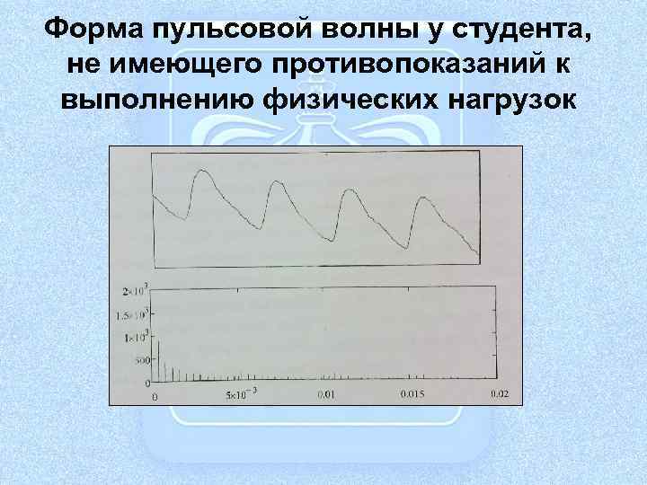 Форма пульсовой волны у студента, не имеющего противопоказаний к выполнению физических нагрузок 