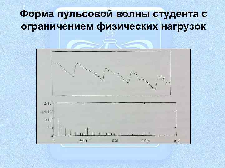 Форма пульсовой волны студента с ограничением физических нагрузок 