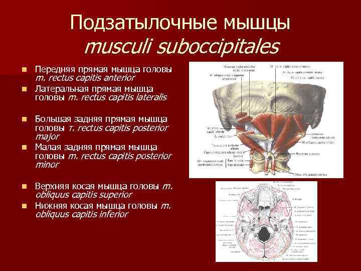 Подзатылочные мышцы musculi suboccipitales n Передняя прямая мышца головы n Латеральная прямая мышца головы