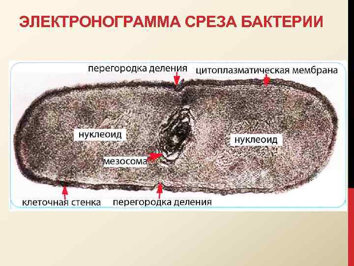 ЭЛЕКТРОНОГРАММА СРЕЗА БАКТЕРИИ 
