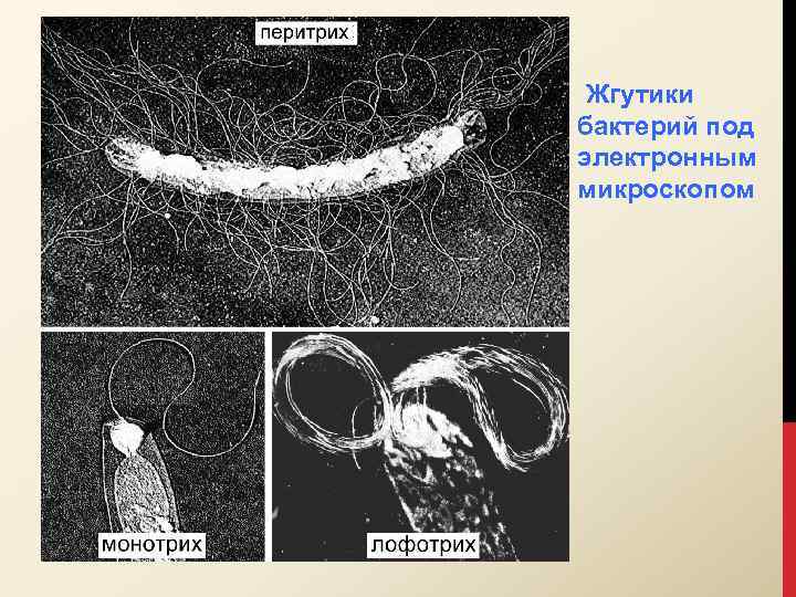 Жгутики бактерий под электронным микроскопом 
