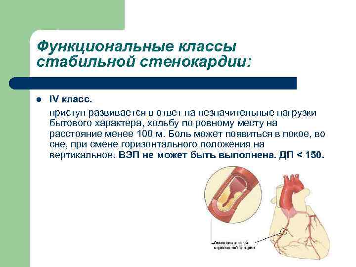 Функциональные классы стабильной стенокардии: l IV класс. приступ развивается в ответ на незначительные нагрузки