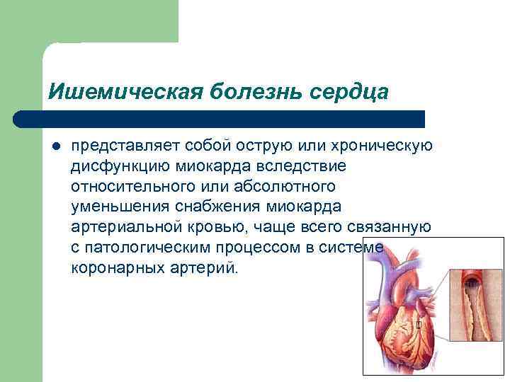 Ишемическая болезнь сердца l представляет собой острую или хроническую дисфункцию миокарда вследствие относительного или