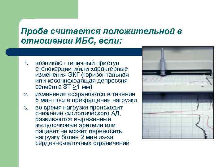 Проба считается положительной в отношении ИБС, если: 1. возникают типичный приступ стенокардии и/или характерные