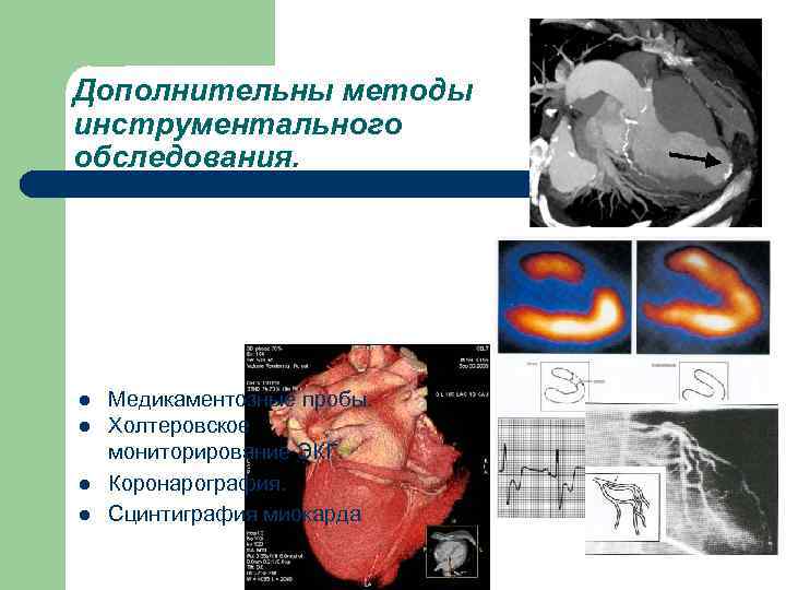 Дополнительны методы инструментального обследования. l Медикаментозные пробы. l Холтеровское мониторирование ЭКГ. l Коронарография. l