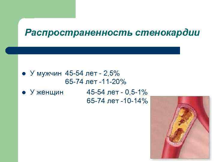 Распространенность стенокардии l У мужчин 45 -54 лет - 2, 5% 65 -74 лет