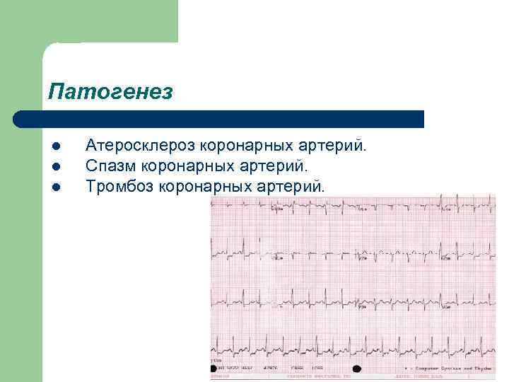 Патогенез l Атеросклероз коронарных артерий. l Спазм коронарных артерий. l Тромбоз коронарных артерий. 