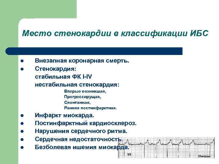 Место стенокардии в классификации ИБС l Внезапная коронарная смерть. l Стенокардия: стабильная ФК I-IV