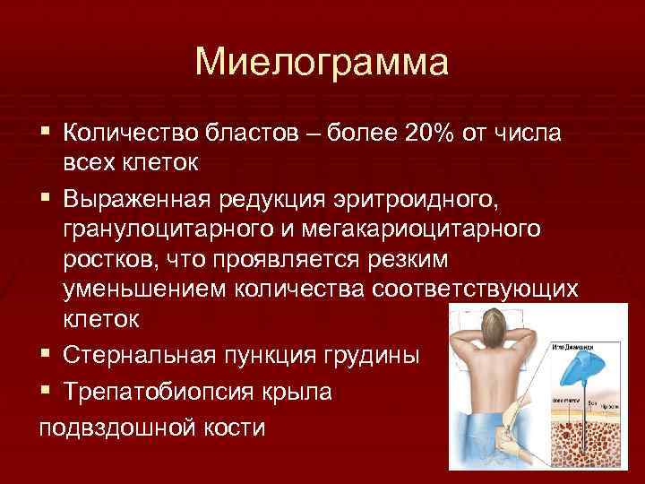 Миелограмма § Количество бластов – более 20% от числа всех клеток § Выраженная редукция
