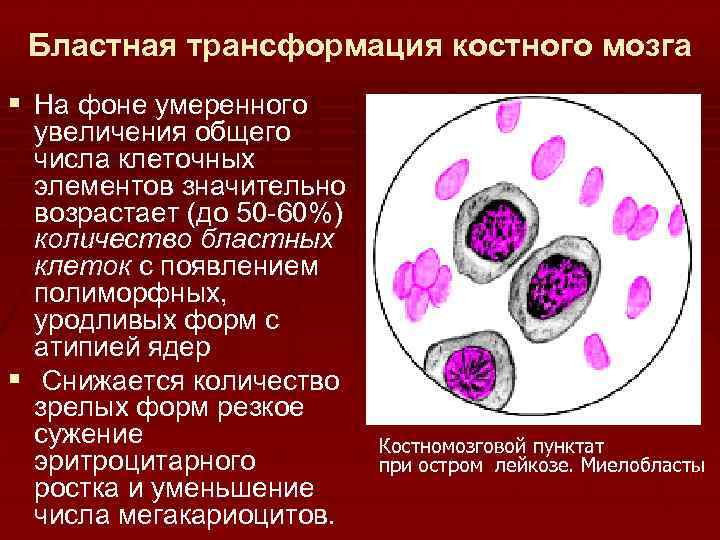 При хроническом моноцитарном лейкозе в картине крови характерен