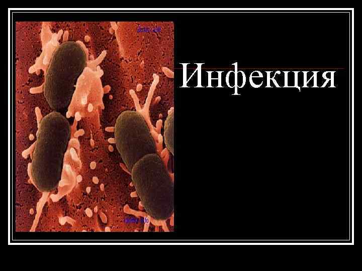 Инфекция 