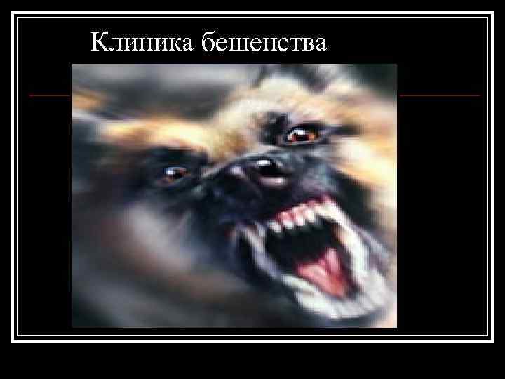 Клиника бешенства 