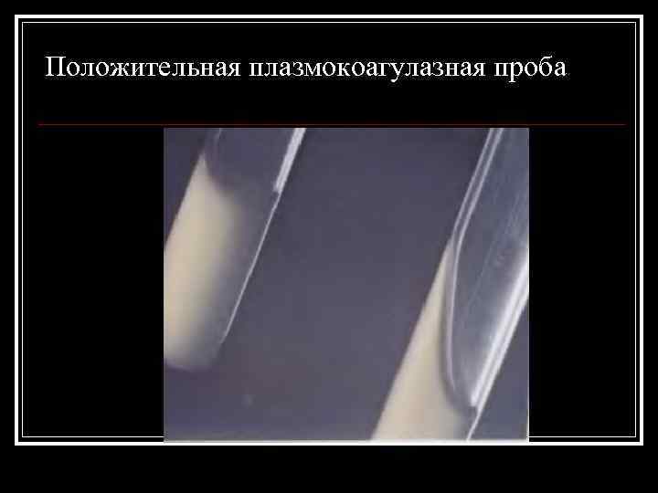 Положительная плазмокоагулазная проба 