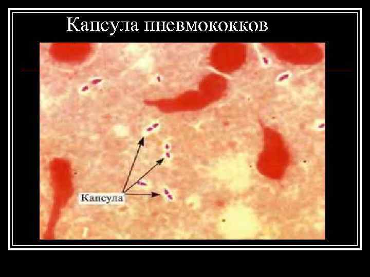 Капсула пневмококков 
