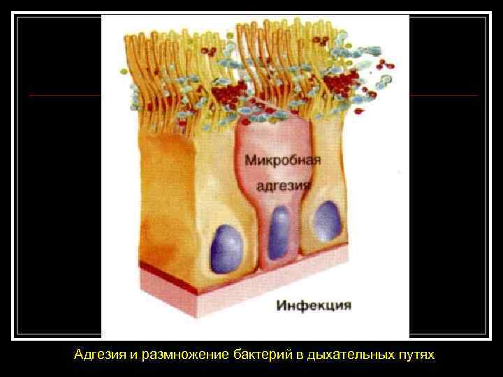 Адгезия и размножение бактерий в дыхательных путях 
