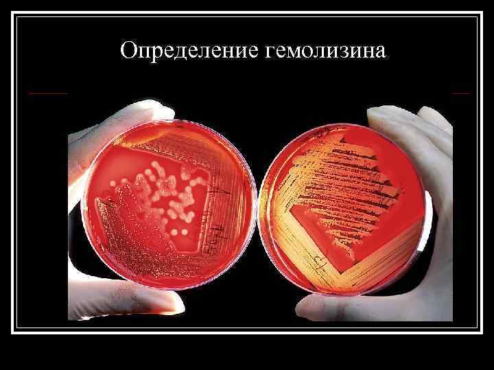 Определение гемолизина 