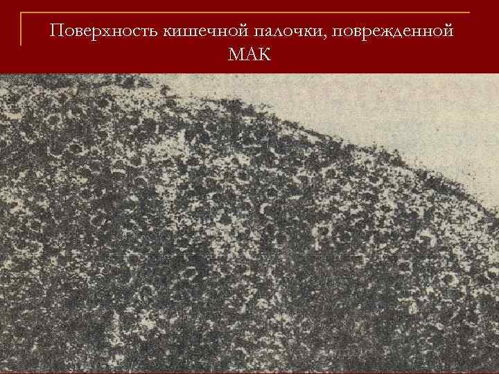 Поверхность кишечной палочки, поврежденной МАК 