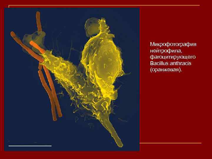 Микрофотография нейтрофила, фагоцитирующего Bacillus anthracis (оранжевая). 