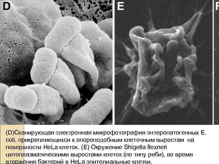 (D)Сканирующая электронная микрофотография энтеропатогенных Е. coli, прикрепляющихся к опороподобным клеточным выростам на поверхности He.
