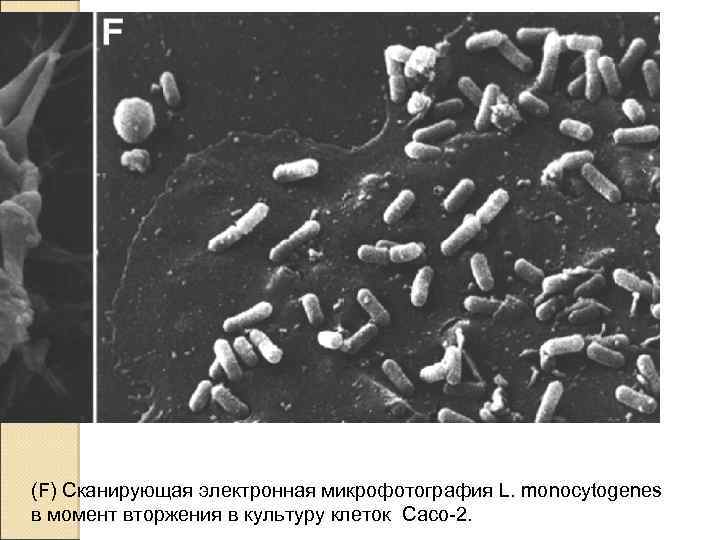 (F) Сканирующая электронная микрофотография L. monocytogenes в момент вторжения в культуру клеток Caco-2. 