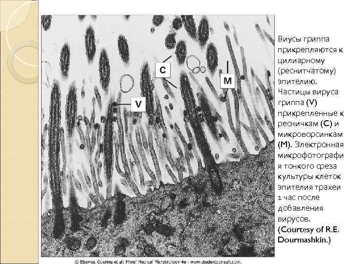 Виусы гриппа прикрепляются к цилиарному (реснитчатому) эпителию. Частицы вируса гриппа (V) прикрепленные к ресничкам