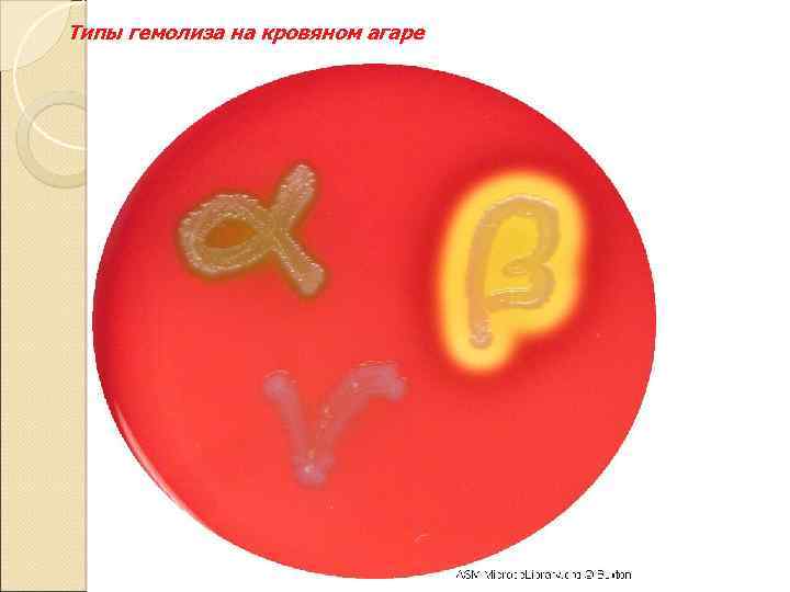 Типы гемолиза на кровяном агаре 