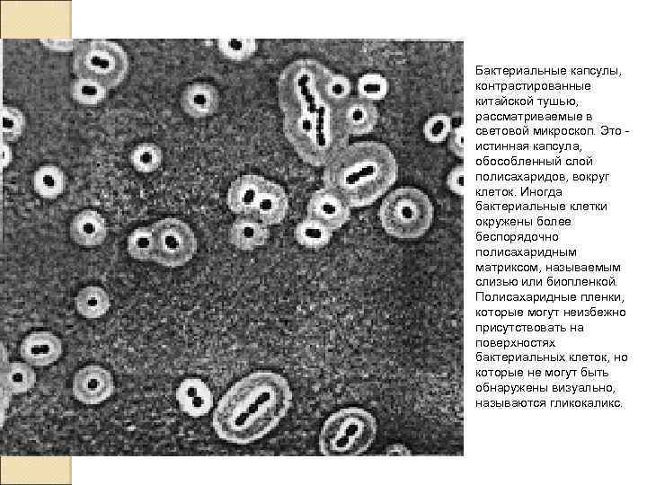 Бактериальные капсулы, контрастированные китайской тушью, рассматриваемые в световой микроскоп. Это - истинная капсула, обособленный