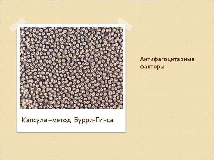 Антифагоцитарные факторы Капсула –метод Бурри-Гинса 
