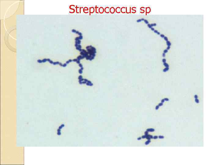 Streptococcus sp 