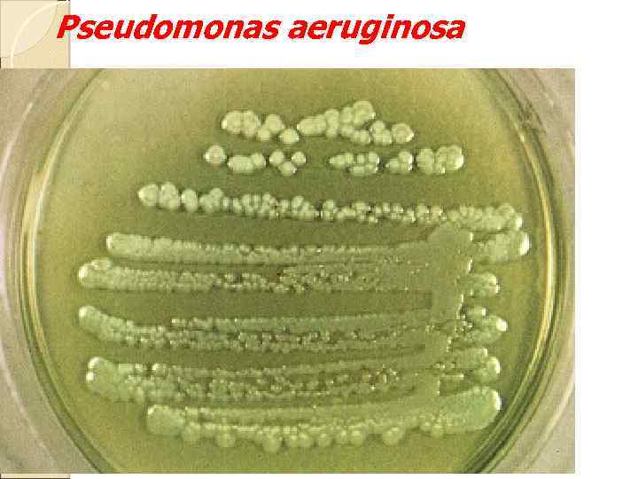 Pseudomonas aeruginosa 