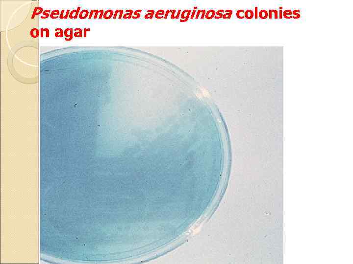 Pseudomonas aeruginosa colonies on agar 