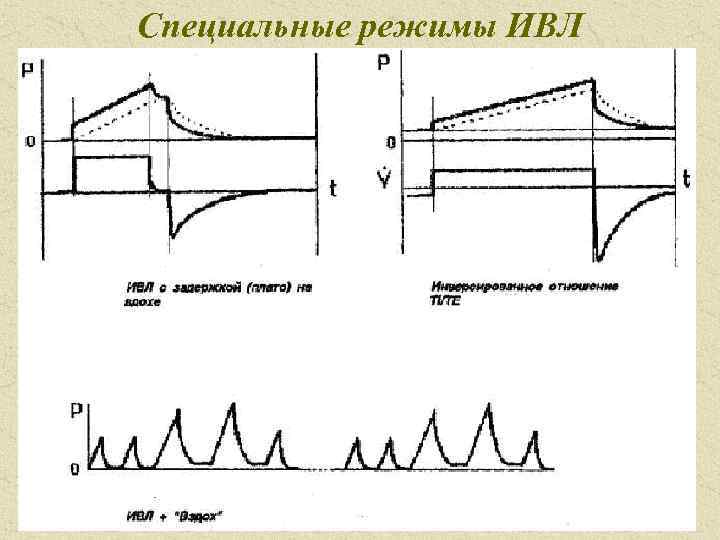 Специальные режимы ИВЛ 