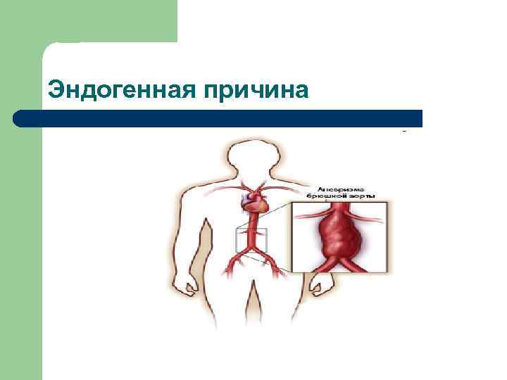 Эндогенная причина 