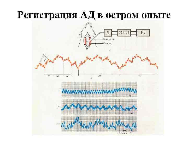 Регистрация АД в остром опыте 