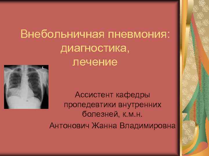 Внебольничная пневмония: диагностика, лечение Ассистент кафедры пропедевтики внутренних болезней, к. м. н. Антонович Жанна