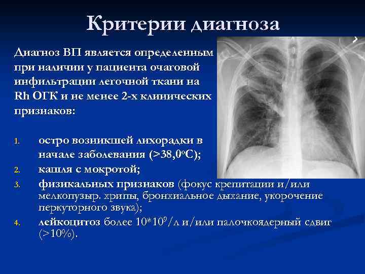 Легочный рисунок сгущен в нижних отделах