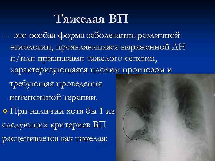 Тяжелая ВП – это особая форма заболевания различной этиологии, проявляющаяся выраженной ДН и/или признаками
