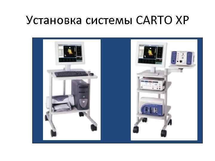 Установка системы CARTO XP 