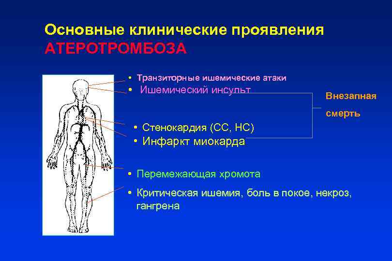 Основные клинические проявления АТЕРОТРОМБОЗА • Транзиторные ишемические атаки • Ишемический инсульт Внезапная смерть •