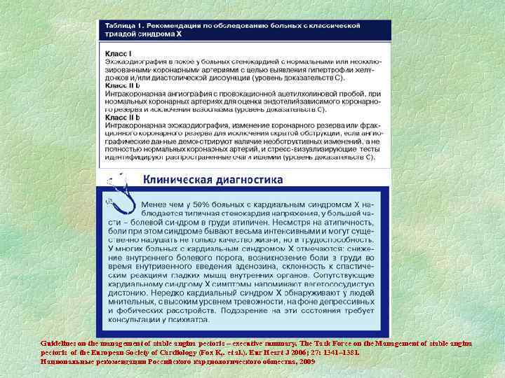 Guidelines on the management of stable angina pectoris – executive summary. The Task Force