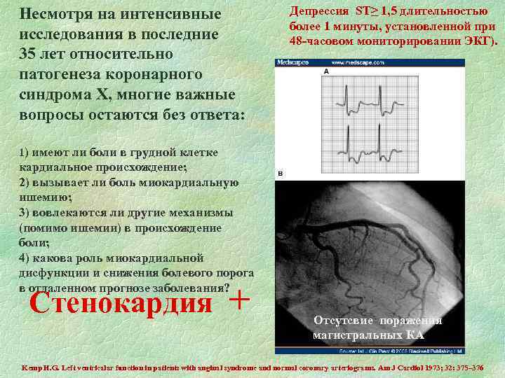 Несмотря на интенсивные исследования в последние 35 лет относительно патогенеза коронарного синдрома Х, многие