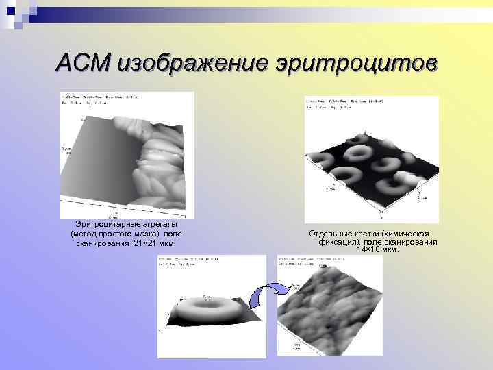 АСМ изображение эритроцитов Эритроцитарные агрегаты (метод простого мазка), поле сканирования 21× 21 мкм. Отдельные