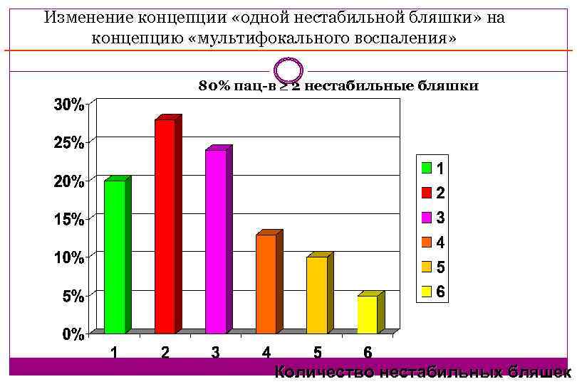Изменение концепции «одной нестабильной бляшки» на концепцию «мультифокального воспаления» 80% пац-в 2 нестабильные бляшки