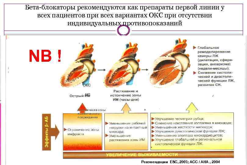 Бета-блокаторы рекомендуются как препараты первой линии у всех пациентов при всех вариантах ОКС при