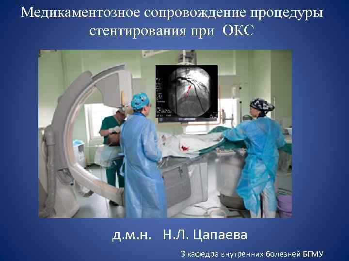 Медикаментозное сопровождение процедуры стентирования при ОКС д. м. н. Н. Л. Цапаева 3 кафедра