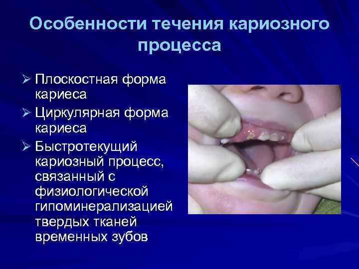 Особенности течения кариозного процесса Ø Плоскостная форма кариеса Ø Циркулярная форма кариеса Ø Быстротекущий
