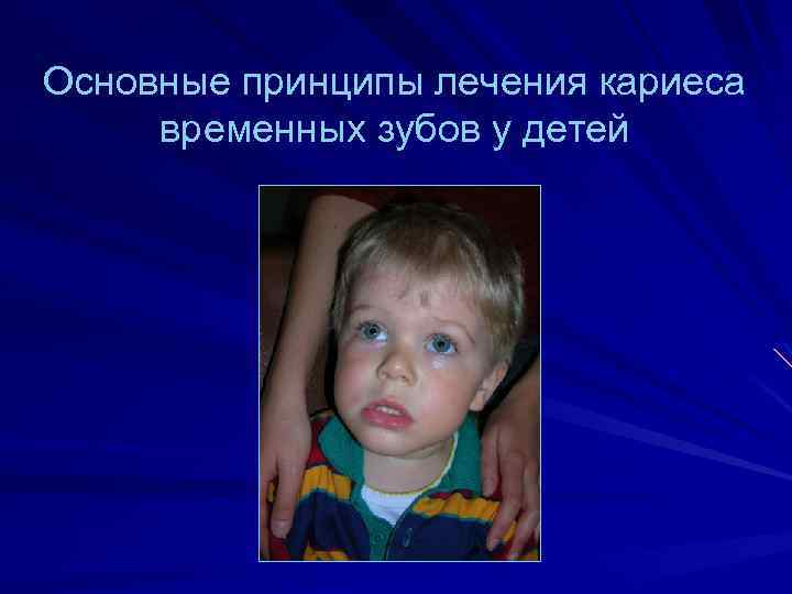 Основные принципы лечения кариеса временных зубов у детей 