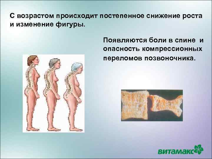 С возрастом происходит постепенное снижение роста и изменение фигуры. Появляются боли в спине и