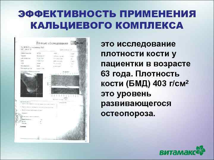 ЭФФЕКТИВНОСТЬ ПРИМЕНЕНИЯ КАЛЬЦИЕВОГО КОМПЛЕКСА это исследование плотности кости у пациентки в возрасте 63 года.